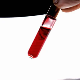 گردنبند طرح شیشه خون