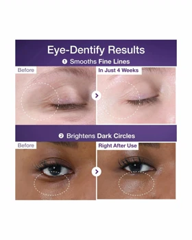 کرم دور چشم رتینول و NAD جوانساز نامبوزین (numbuzin)