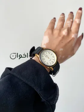 ساعت کیو اندکیو بند پارچه ای(باوک)