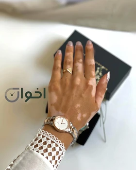 ساعت دنیل ولینگتون آیکونیک گرد اصلی