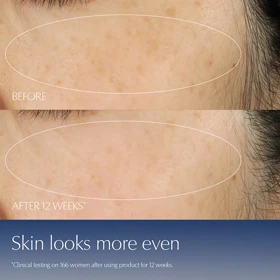 سرم ضد چروک استی لادر, مدل Advanced Night Repair حاوی رتینول حجم 100 میلی‌لیتر