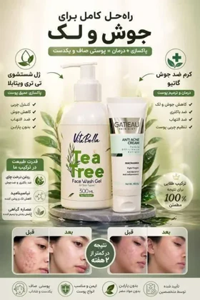 پک ضد جوش و لک با کرم گاتیو و ژل شستشو ویتابلا