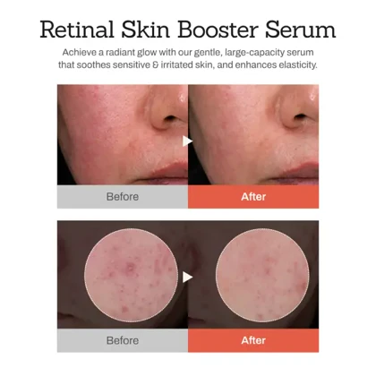 بوستر سرم رتینال صورت و بدن مدی‌تراپی MEDITHERAPY