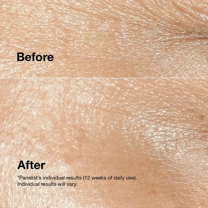 کرم ضدچروک صورت کلینیک, مدل Smart Clinical Repair مناسب انواع پوست حجم 50 میلی‌لیتر