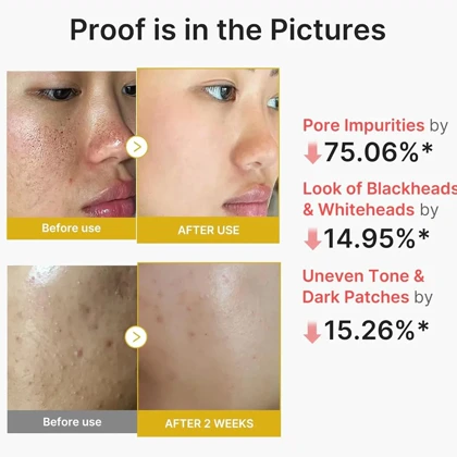 سرم پیل شات زردچوبه و کوجیک اسید مدی کیوب Medicube لایه بردار 80ml