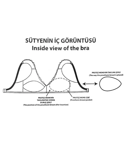 پروتز سینه مدل اشکی Yeni Inci ینی اینجی کد 82