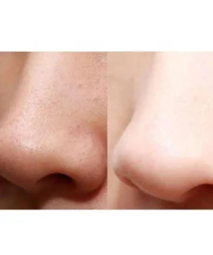 اتو صورت اولتراسونیک شاول 6835