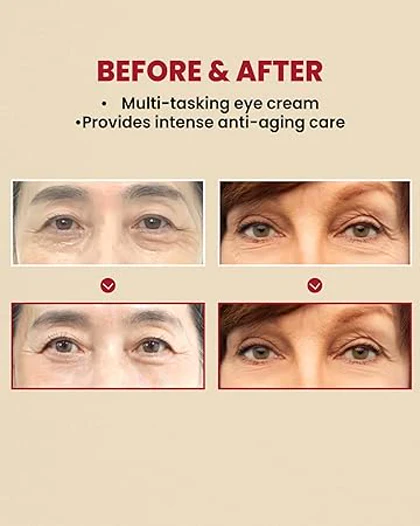 کرم دور چشم سئول 1988 لیپوزوم رتینال و بین کی سکرت 30 میل