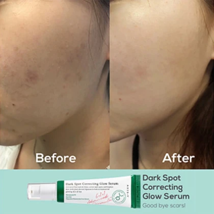 سرم صورت اکسیس وای AXIS-Y مدل Dark Spot Glow