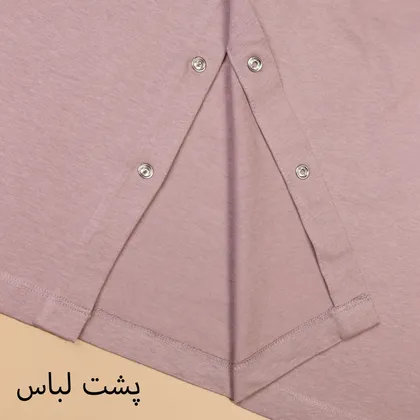 تونیک سوگل