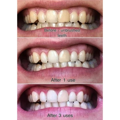 خمیردندان سفید کننده مارویس (MARVIS )