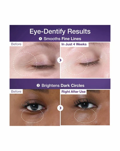 کرم دور چشم رتینول و NAD جوانساز نامبوزین (numbuzin)