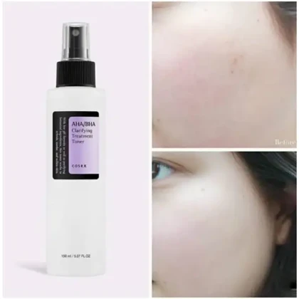 تونر لایه بردار AHA و BHA کوزارکس 100 میل