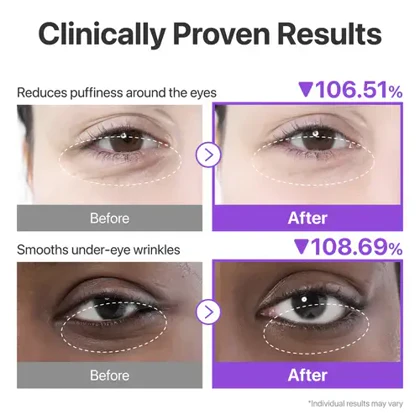 پچ زیر چشم نامبوزین شماره 9 numbuzin