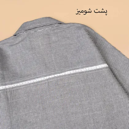 تونیک راه راه شاتوت