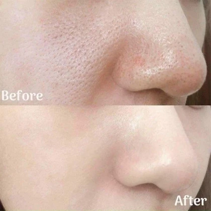 آمپول لایه‌بردار برنج سفید ملاکسین Dr.Melaxin مدل Peel Shot White Rice