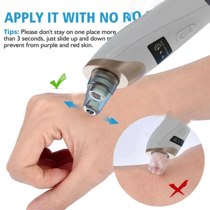 میکرودرم خانگی قابل تنظیم ومکش قوی مدل HY9