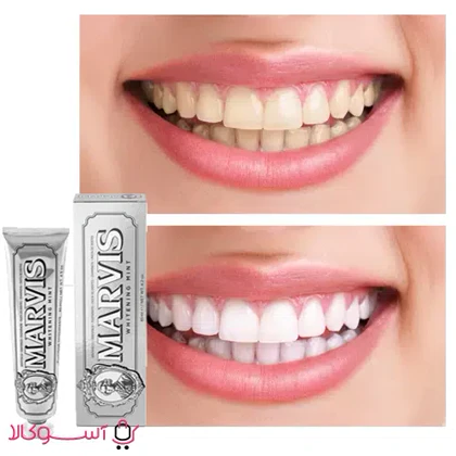 خمیر دندان سفید کننده مارویس مدل whitening mint
