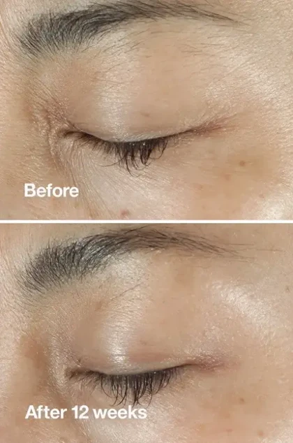 کرم دور چشم ضد چروک کلینیک (Clinique)