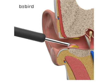 دستگاه آندوسکوپی و پاک کننده داخل گوش شیائومی Xiaomi Bebird R1