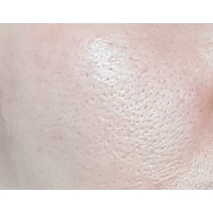 آمپول کوچک کننده منافذ سنتلا اسکین Skin 1004 ماداگاسکار 100 میل