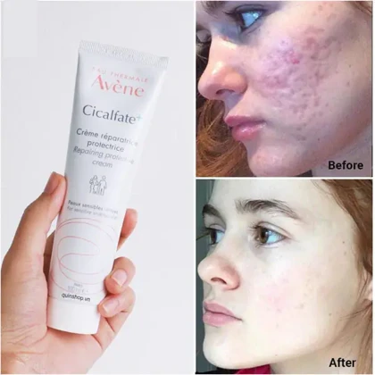 کرم ترمیم کننده سیکالفیت پلاس اونAvene