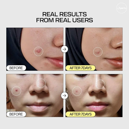 اسنس حلزون جومیسو|JUMISO SNAIL MUCIN 95% + PEPTIDE FACIAL ESSENCE