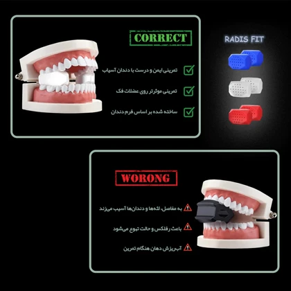زاویه ساز فک رادیس فیت مدل Full Weight بسته شش عددی
