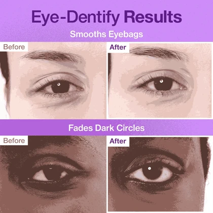 پچ زیر چشم نامبوزین 9+ ضد چروک، ضدپف و تیرگی (Numbuzin)