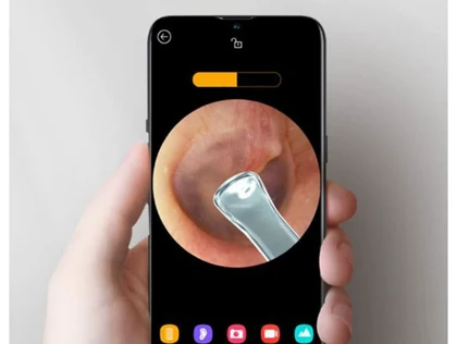 دستگاه آندوسکوپی و پاک کننده داخل گوش شیائومی Xiaomi Bebird R1