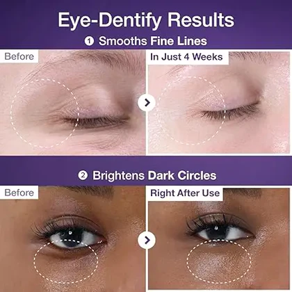 کرم دور چشم نامبوزین شماره 9 حجم 10 میل (Numbuzin No.9 Eye Cream)