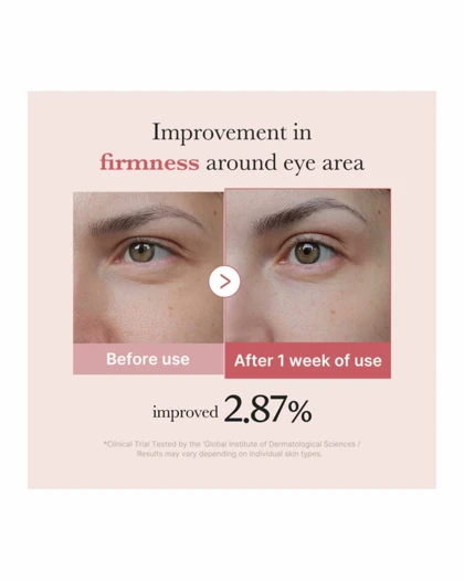 کرم دور چشم پپتید صورتی مدیکیوب (medicube)