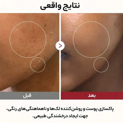 تونر برنج روشن‌کننده صورت ملاکسین Dr.Melaxin مدل Peel Shot Glow Rice