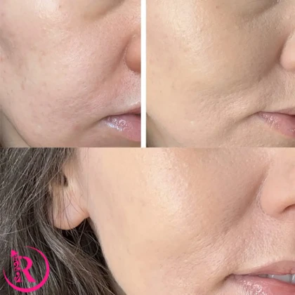 کوشن TIRTIR مدل Mask Fit Red Cushion رنگ 21W Natürliches Elfenbein