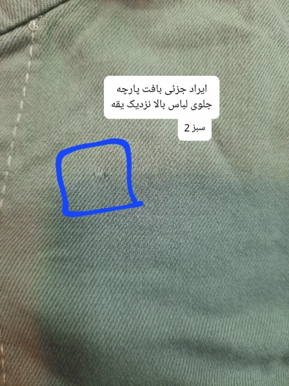 مانتو دخترانه چیچک ( دارای ایراد جزئی )