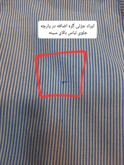 مانتو راه راه ترندی ( دارای ایراد جزئی ) ☆