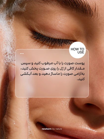 تونر پوست چرب و منافذ باز نیو برن