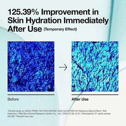 پد تونر PDRN و هیالورون آنوا 180 میل