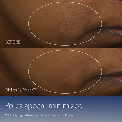 سرم ضد چروک استی لادر, مدل Advanced Night Repair حاوی رتینول حجم 100 میلی‌لیتر