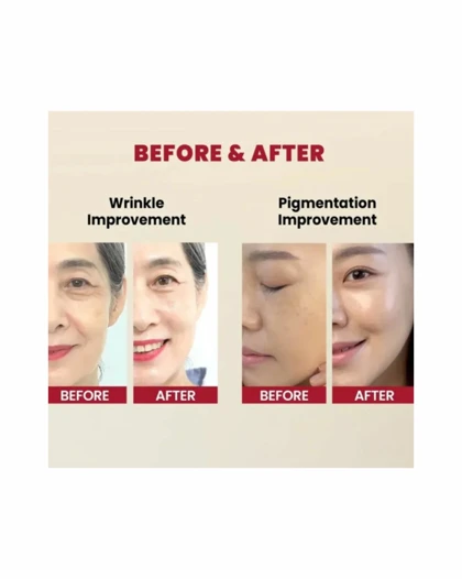 سرم رتینال جوانساز لیپوزومال سئول 1988 (SEOUL 1988)