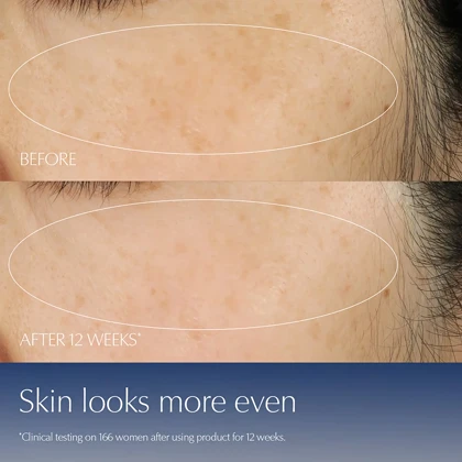 سرم ضد چروک استی لادر, مدل Advanced Night Repair حاوی رتینول حجم 100 میلی‌لیتر