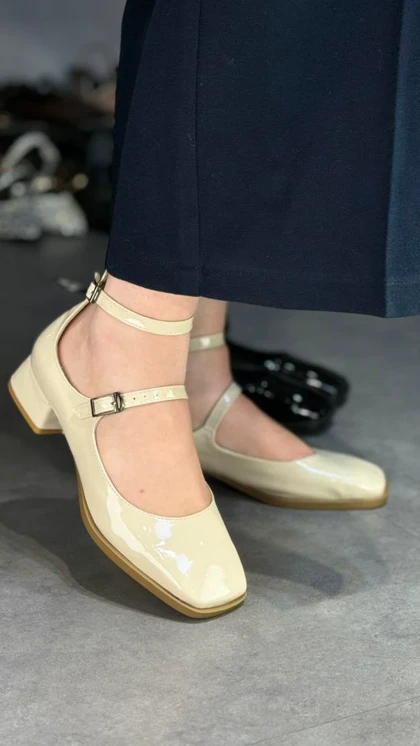 P315 - پاشنه خوکیP315