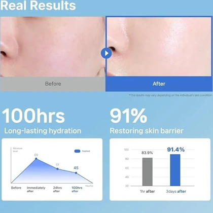کرم مرطوب کننده صورت و بدن ایلیون مدل Ceramide Ato Concentrate مناسب پوست خشک و حساس حجم 200 میل