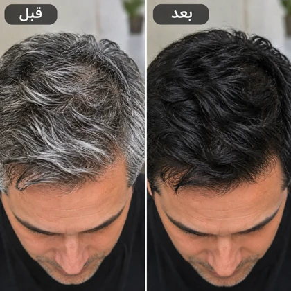 شامپو رنگ مو بابل موس 500 میل (پک اورجینال تستردار)