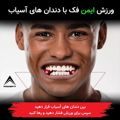 زاویه ساز فک رادیس فیت مدل Full Weight بسته شش عددی