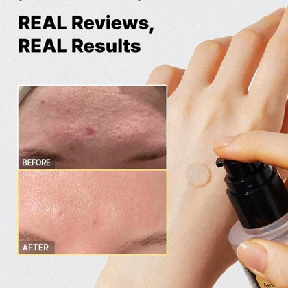 اسنس حلزون کوزارکس مدل ادونس اسنیل 96 موکین پاور Cosrx Advanced Snail 96 Mucin Power Essence