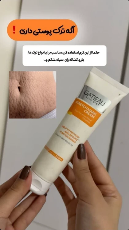 کرم رفع ترک‌های پوستی گاتیو