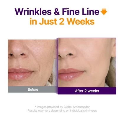سرم جوانساز پیوریتو مدل Retinol Retinal 2000