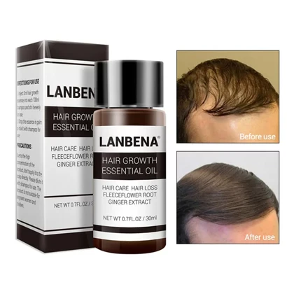 روغن رشد و تقویت مو لانبنا LANBENA