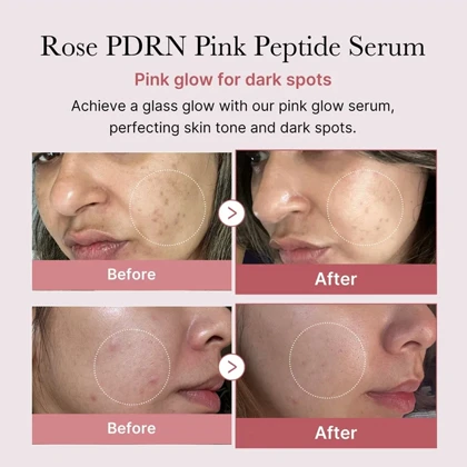 سرم صورت پپتاید جوانساز مدی کیوب medicube اصل مدل Pink حجم 30ML